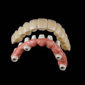 implant